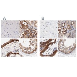 Invitrogen CD2AP Polyclonal Antibody 100 &mu;L; Unconjugated:Antikroppar