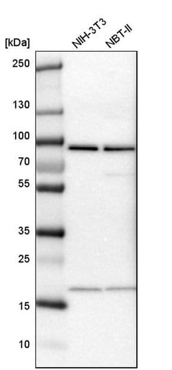 Invitrogen CD2AP Polyclonal Antibody 100 &mu;L; Unconjugated:Antikroppar