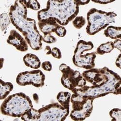 Invitrogen MAGEA10 Polyclonal Antibody 100 &mu;L; Unconjugated:Antibodies,