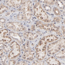 Invitrogen RNF213 Polyclonal Antibody 100 &mu;L; Unconjugated:Antibodies,