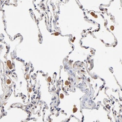 Invitrogen RNF213 Polyclonal Antibody 100 &mu;L; Unconjugated:Antibodies,