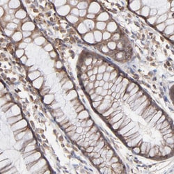 Invitrogen RNF213 Polyclonal Antibody 100 &mu;L; Unconjugated:Antibodies,