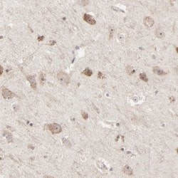 Invitrogen RNF213 Polyclonal Antibody 100 &mu;L; Unconjugated:Antibodies,