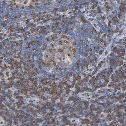 Invitrogen SH3KBP1 Polyclonal Antibody 100 &mu;L; Unconjugated:Antibodies,