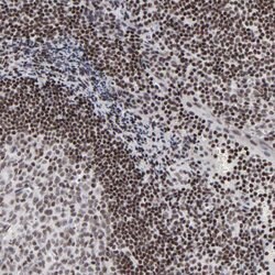 Invitrogen SP2 Polyclonal Antibody 100 &mu;L; Unconjugated:Antibodies,