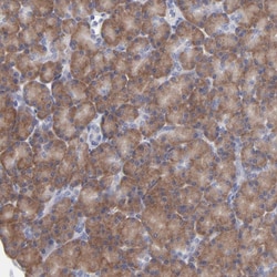 Invitrogen RPS24 Polyclonal Antibody 100 &mu;L | Buy Online | Invitrogen&trade; | Fisher Scientific