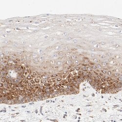 Invitrogen RPS21 Polyclonal Antibody 100 &mu;L; Unconjugated:Antibodies,