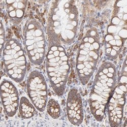 Invitrogen RPS21 Polyclonal Antibody 100 &mu;L; Unconjugated:Antibodies,