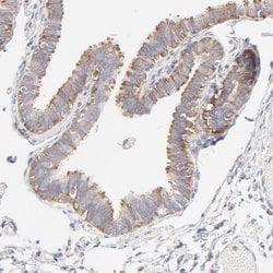 Invitrogen RPS21 Polyclonal Antibody 100 &mu;L; Unconjugated:Antibodies,