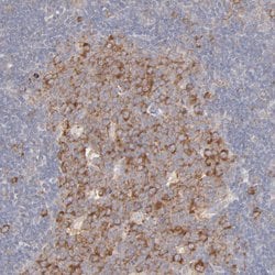 Invitrogen RPS21 Polyclonal Antibody 100 &mu;L; Unconjugated:Antibodies,