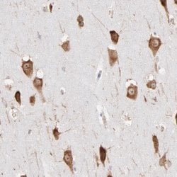 Invitrogen RPL9 Polyclonal Antibody 100 &mu;L; Unconjugated:Antibodies,