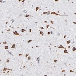 Invitrogen RPL9 Polyclonal Antibody 100 &mu;L; Unconjugated:Antibodies,