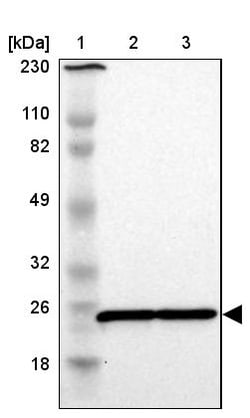 Invitrogen RPL9 Polyclonal Antibody 100 &mu;L | Buy Online | Invitrogen&trade; | Fisher Scientific