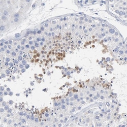Invitrogen ZCCHC13 Polyclonal Antibody 100 &mu;L; Unconjugated:Antibodies,