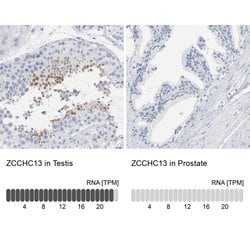 Invitrogen ZCCHC13 Polyclonal Antibody 100 &mu;L; Unconjugated:Antibodies,