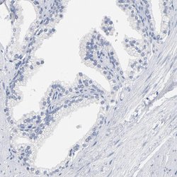 Invitrogen ZCCHC13 Polyclonal Antibody 100 &mu;L; Unconjugated:Antibodies,
