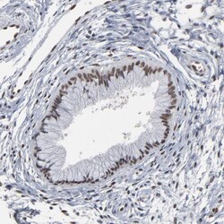 Invitrogen ATF7 Polyclonal Antibody 100 &mu;L; Unconjugated:Antibodies,