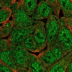 Invitrogen KIAA0323 Polyclonal Antibody 100 &mu;L; Unconjugated:Antibodies,
