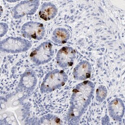 Invitrogen KIAA0323 Polyclonal Antibody 100 &mu;L; Unconjugated:Antibodies,