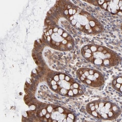 Invitrogen IVNS1ABP Polyclonal Antibody 100 &mu;L; Unconjugated:Antibodies,