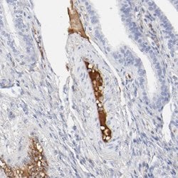 Invitrogen tPA Polyclonal Antibody 100 &mu;L; Unconjugated:Antibodies,