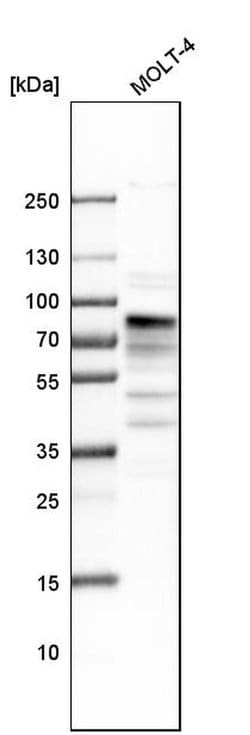 Invitrogen MSL2 Polyclonal Antibody 100 &mu;L | Buy Online | Invitrogen&trade; | Fisher Scientific