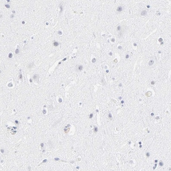 Invitrogen LTBP2 Polyclonal Antibody 100 &mu;L; Unconjugated:Antibodies,