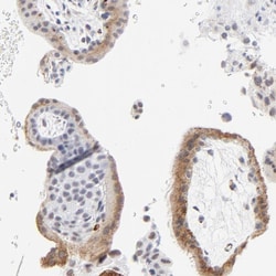 Invitrogen LTBP2 Polyclonal Antibody 100 &mu;L; Unconjugated:Antibodies,