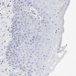 Invitrogen LTBP2 Polyclonal Antibody 100 &mu;L; Unconjugated:Antibodies,
