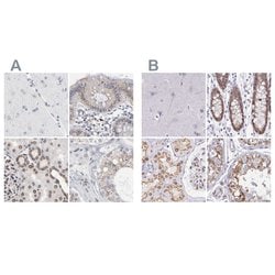 Invitrogen Nesprin 2 Polyclonal Antibody 100 &mu;L; Unconjugated:Antibodies,
