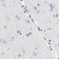 Invitrogen Nesprin 2 Polyclonal Antibody 100 &mu;L; Unconjugated:Antibodies,