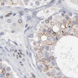 Invitrogen Nesprin 2 Polyclonal Antibody 100 &mu;L; Unconjugated:Antibodies,