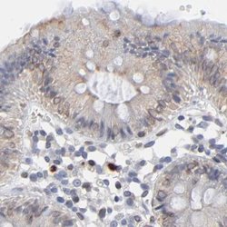 Invitrogen Nesprin 2 Polyclonal Antibody 100 &mu;L; Unconjugated:Antibodies,