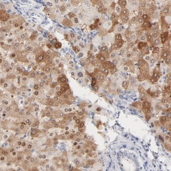 Invitrogen HNF6 Polyclonal Antibody 100 &mu;L | Buy Online | Invitrogen&trade; | Fisher Scientific