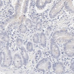 Invitrogen HNF6 Polyclonal Antibody 100 &mu;L | Buy Online | Invitrogen&trade; | Fisher Scientific