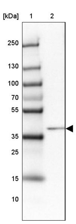 Invitrogen HNF6 Polyclonal Antibody 100 &mu;L | Buy Online | Invitrogen&trade; | Fisher Scientific