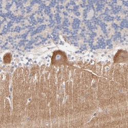 Invitrogen Septin-11 Polyclonal Antibody 100 &mu;L; Unconjugated:Antibodies,