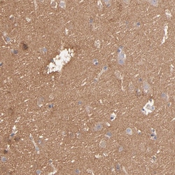 Invitrogen Septin-11 Polyclonal Antibody 100 &mu;L; Unconjugated:Antibodies,
