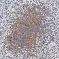 Invitrogen Septin-11 Polyclonal Antibody 100 &mu;L; Unconjugated:Antibodies,