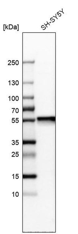 Invitrogen Septin-11 Polyclonal Antibody 100 &mu;L; Unconjugated:Antibodies,
