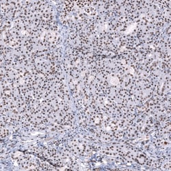 Invitrogen SNRPB Polyclonal Antibody 100 &mu;L; Unconjugated:Antibodies,