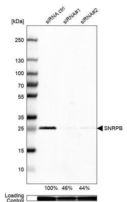 Invitrogen SNRPB Polyclonal Antibody 100 &mu;L; Unconjugated:Antibodies,