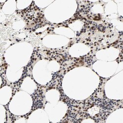 Invitrogen ZNF192 Polyclonal Antibody 100 &mu;L; Unconjugated:Antibodies,