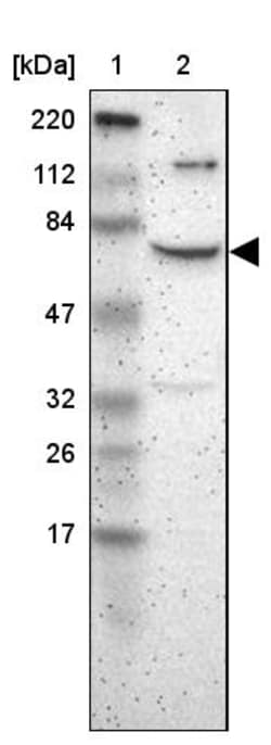 Invitrogen ZNF192 Polyclonal Antibody 100 &mu;L; Unconjugated:Antibodies,