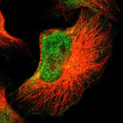Invitrogen FOXN2 Polyclonal Antibody 100 &mu;L; Unconjugated:Antibodies,