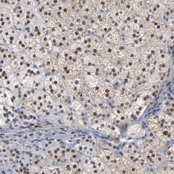 Invitrogen FOXN2 Polyclonal Antibody 100 &mu;L; Unconjugated:Antibodies,