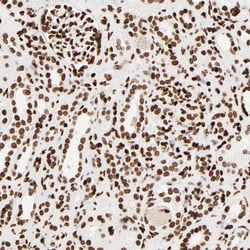 Invitrogen HMGB2 Polyclonal Antibody 100 &mu;L; Unconjugated:Antibodies,
