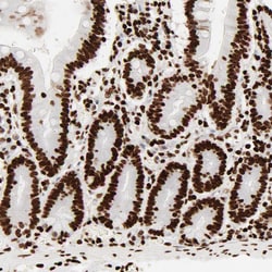 Invitrogen HMGB2 Polyclonal Antibody 100 &mu;L; Unconjugated:Antibodies,