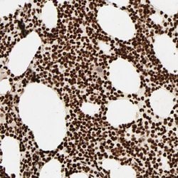 Invitrogen HMGB2 Polyclonal Antibody 100 &mu;L; Unconjugated:Antibodies,