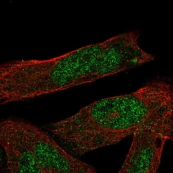 Invitrogen ASB1 Polyclonal Antibody 100 &mu;L; Unconjugated:Antibodies,
